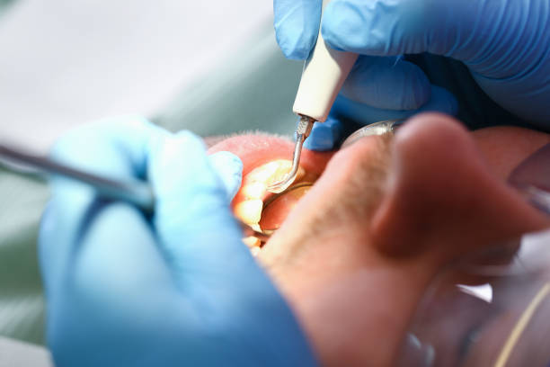 Best Pediatric Emergency Dentist in Barnwell, SC